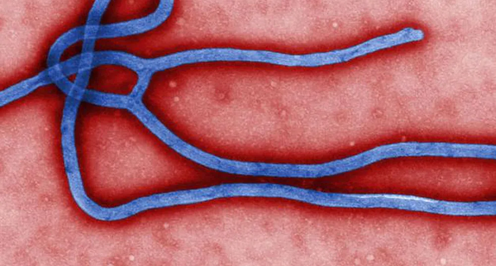 Домейнът Ebola.com се продава за 150 000 долара