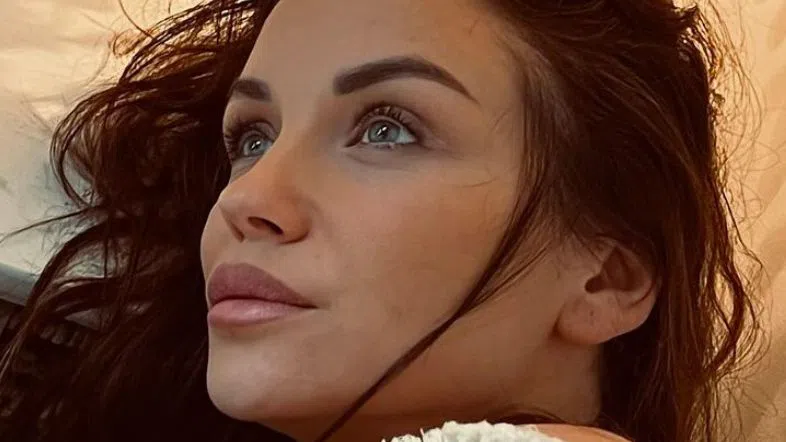 Сложила ли е хиалурон в устните си, Диляна Попова?