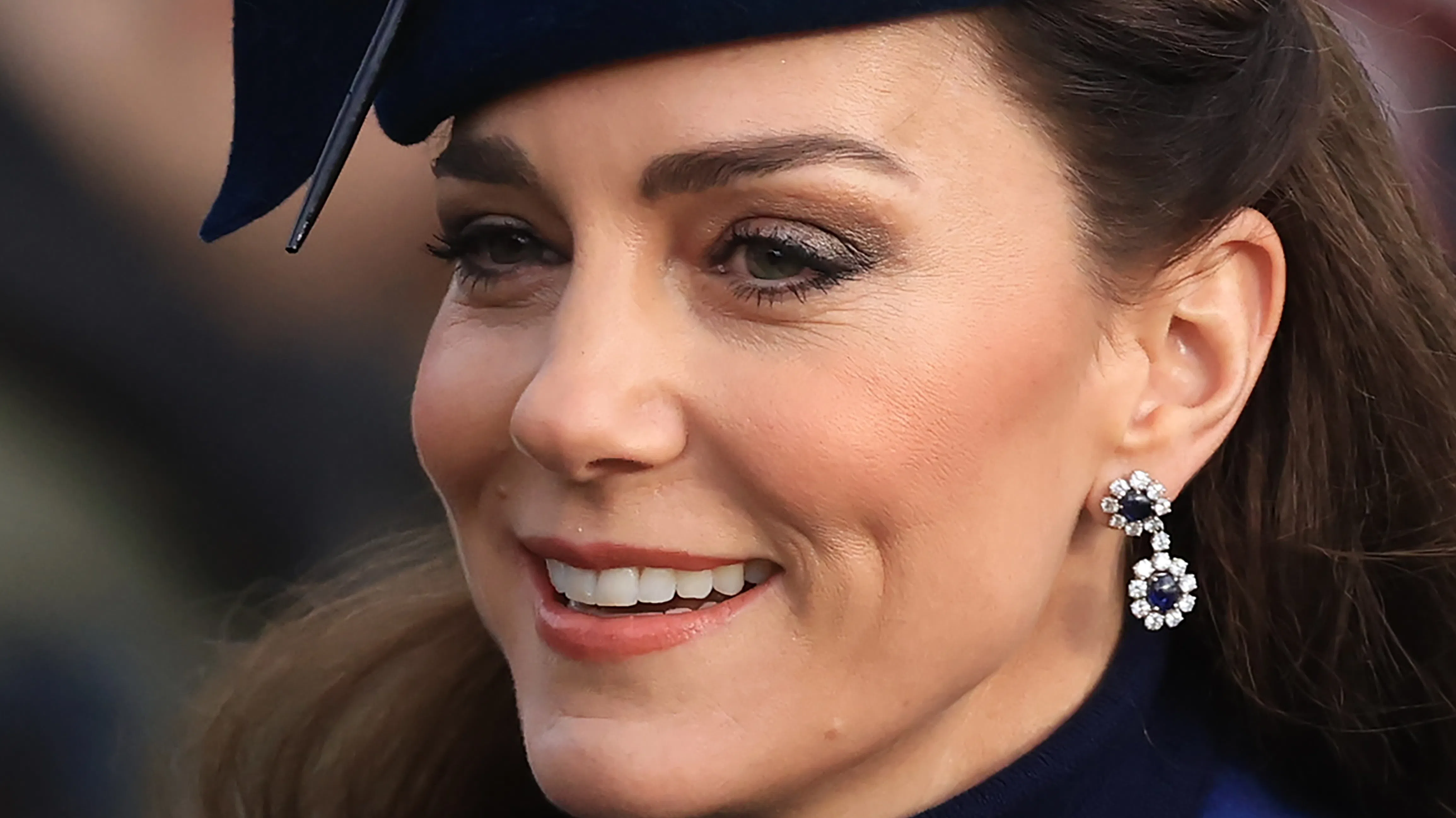 Искате да освежите контура на лицето да го лифтнете малко