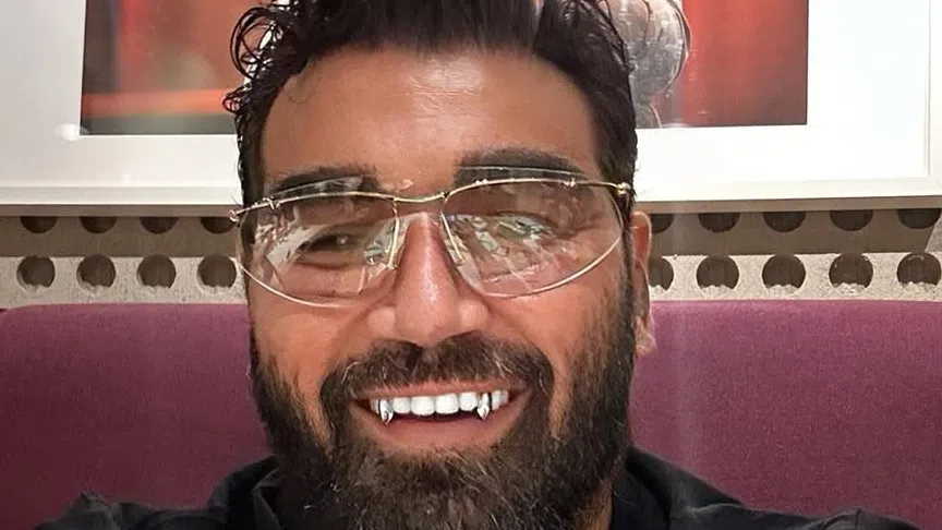 Азис си имплантира вежди Певецът отдавна желае да опита най новия